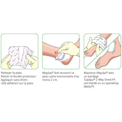 Mepilex 