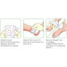 Mepilex 